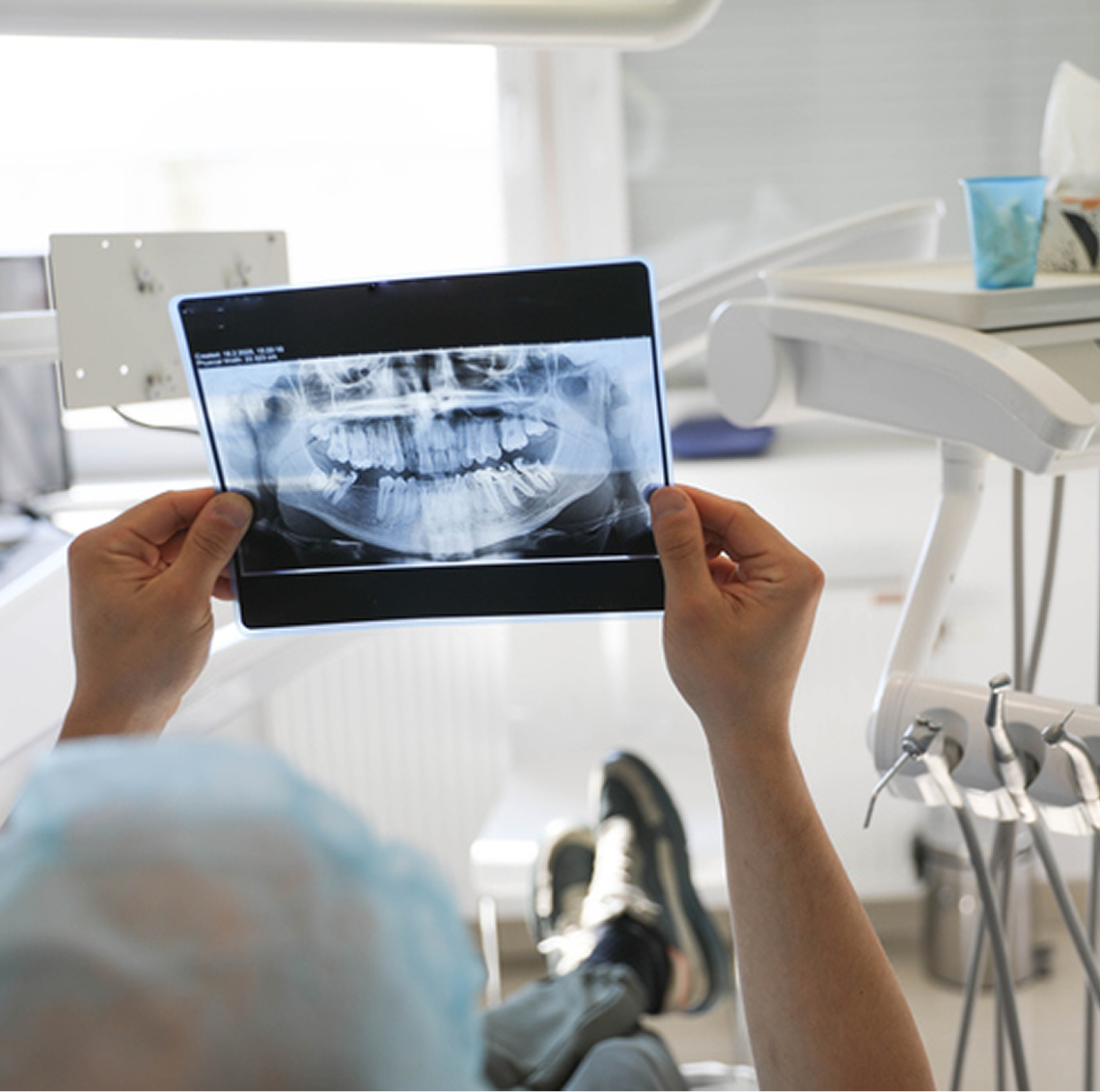 Hands holding dental X-ray in clinic